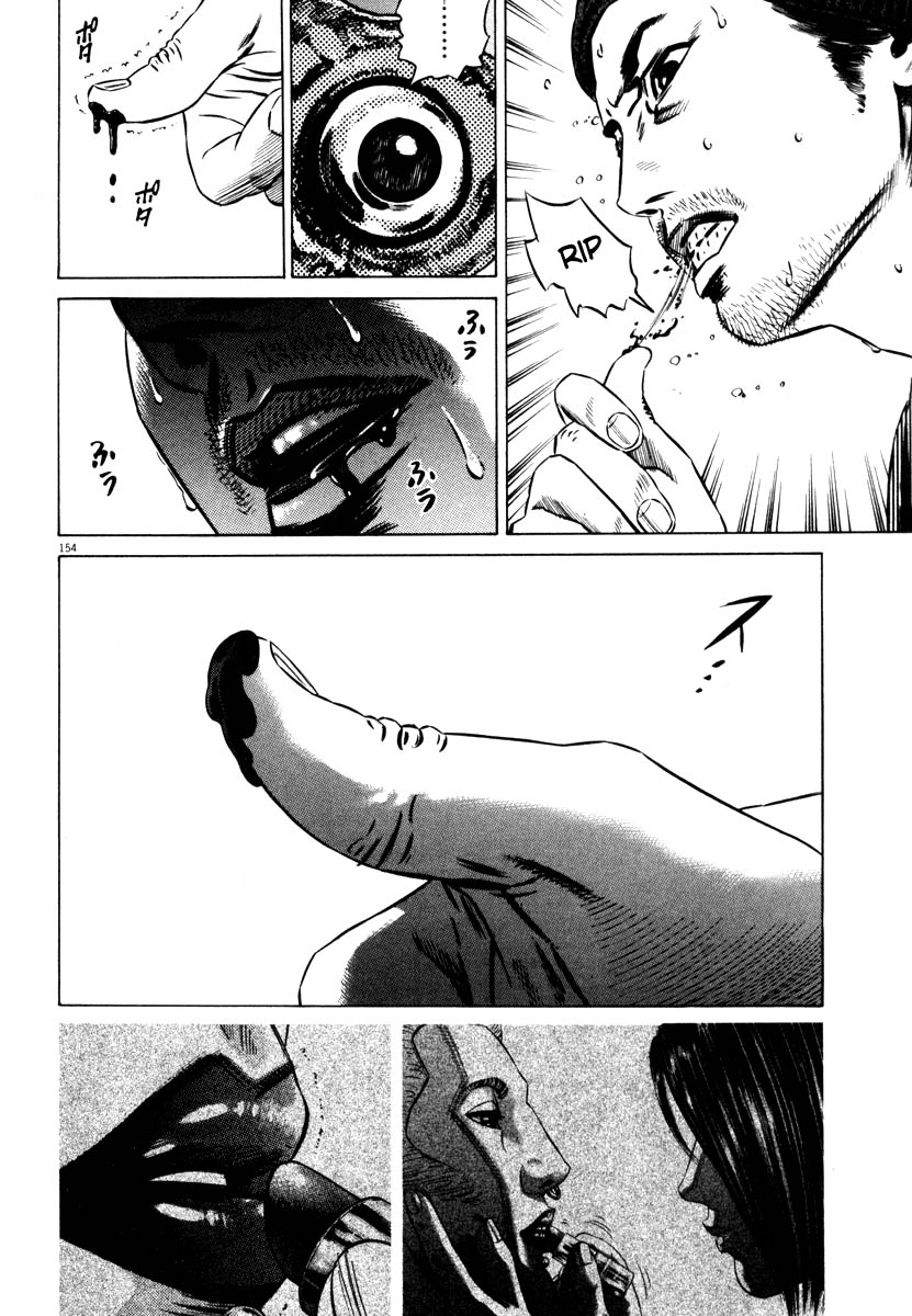 155