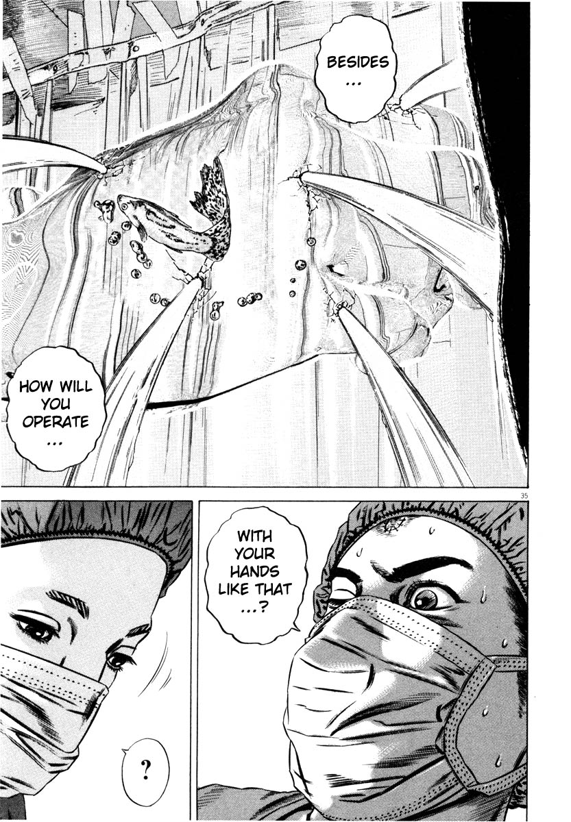 38